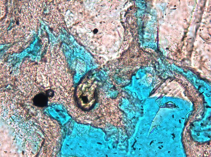 Photomicrograph of thin section made from sample 09RDWES301 (a 2009 Redoubt eruption sample.) The blue material is colored epoxy filling void spaces. The greenish object in the center of the slide is clinopyroxene, and is approximately 50 microns long. The rest of the slide is glass filaments (greyish threads) and plagioclase (white, larger pieces). More information about this sample at this link: http://www.avo.alaska.edu/samples/sample_info.php?sampleID=34735