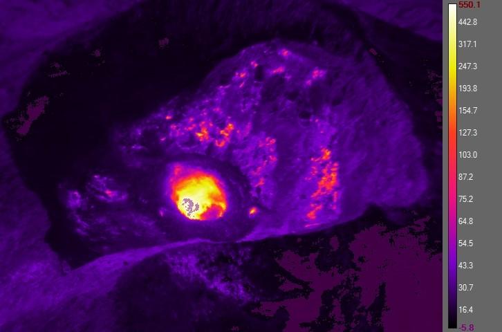 AVO made a summit overflight of Cleveland on July 26. A small dome with a crater in the center was observed in the center of the summit crater. The FLIR indicated temperatures in excess of 600C in the dome crater, and incandescence was observed in the floor of the dome crater. Image by John Lyons, USGS/AVO. 
